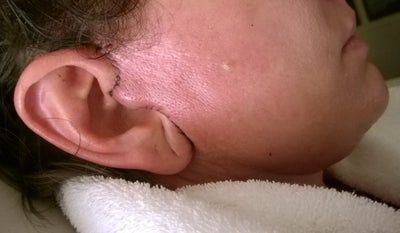 46 tuổi và đã sẵn sàng căng da mặt