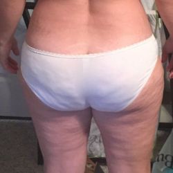 Có thể tạo hình bụng mini và hút mỡ đùi ngoài cùng một lúc không?