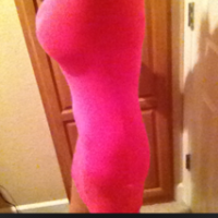 Nữ, 20 tuổi, nên đặt túi độn mông hay cấy mỡ tự thân?