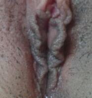 Môi bé dài chảy xệ và âm vật to thì phải làm sao?