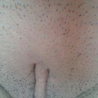 Môi bé dài chảy xệ và âm vật to thì phải làm sao?