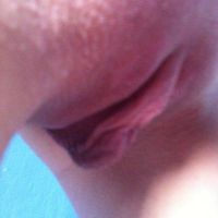 Có phải môi bé của tôi to hơn bình thường không?