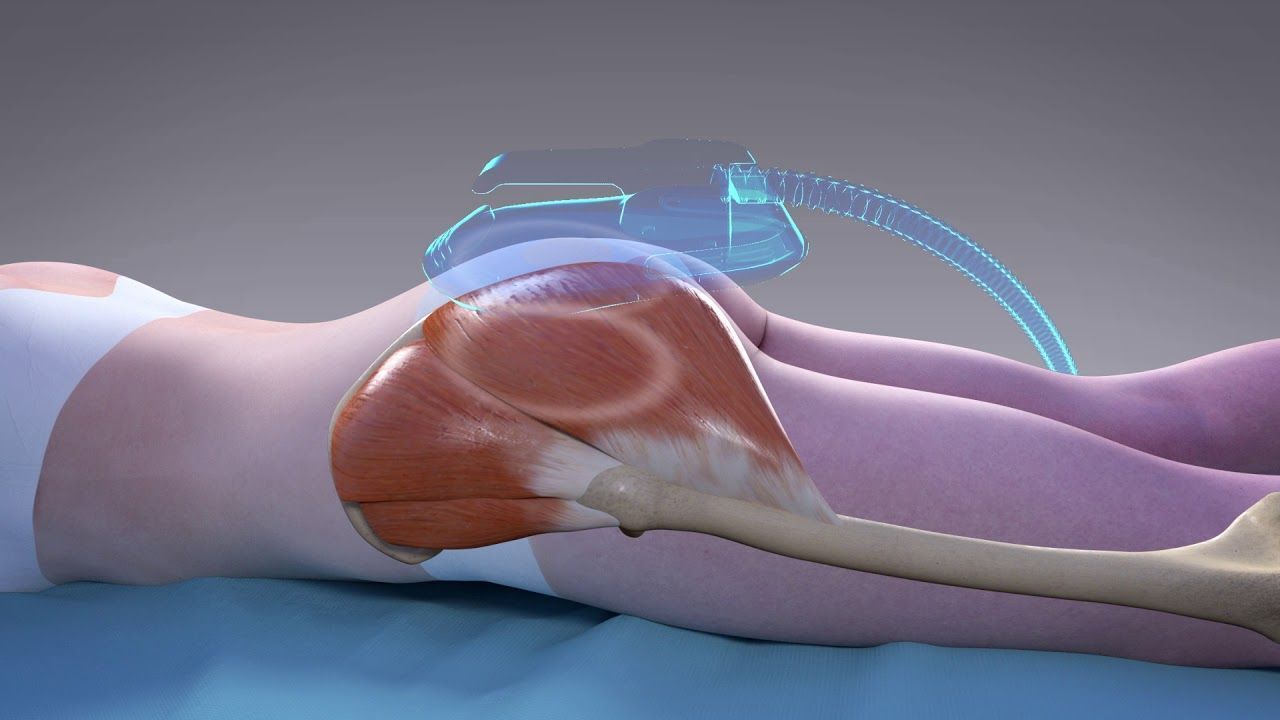 5df82850d8672d26b221677302f40b2b