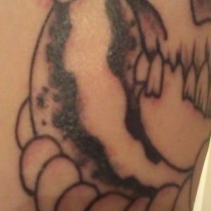 Picosure có xóa được hình xăm màu đen không?