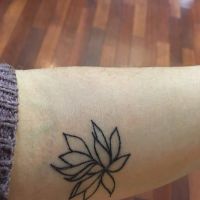 Hình xăm của tôi nên xóa bỏ bằng laser Picosure hay nên cắt bỏ?