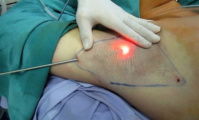 127015 9 noi soi hut mo hoi 9 nach 1 2545378