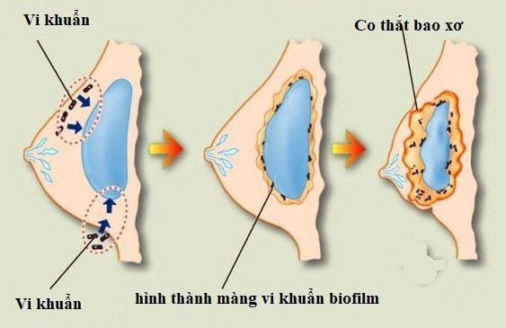 6545cdbd3484a7df1ecb512e63aeabba