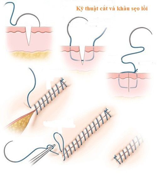 cat seo loi bao nhieu tien