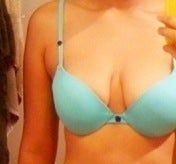 Cách loại bỏ mỡ vùng nách?