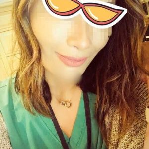 Môi trên sưng to sau khi tiêm Restylane có bình thường không? Tôi đang lo bị biến chứng