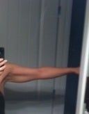 Nên căng da cánh tay hay hút mỡ?