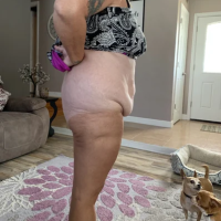 Căng da vùng thân dưới có nâng mông chảy xệ không?