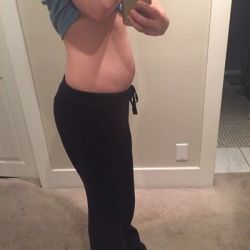 CoolSculpt hay EmSculpt ?