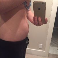 CoolSculpt hay EmSculpt ?