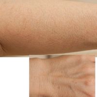 Cách trẻ hóa bàn tay và cánh tay bị lão hóa sớm?