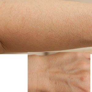 Cách trẻ hóa bàn tay và cánh tay bị lão hóa sớm?