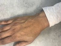 Cách trẻ hóa bàn tay thô ráp và sạm đen