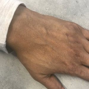 Cách trẻ hóa bàn tay thô ráp và sạm đen