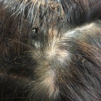 Đây có phải là rụng tóc từng vùng không?