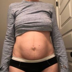 EmSculpt hay tạo hình thành bụng để làm săn chắc cơ bụng