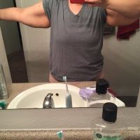 Nên căng da cánh tay ngay hay nên tiếp tục giảm cân thêm rồi mới phẫu thuật? Nên căng da cánh tay ngay hay nên tiếp tục giảm cân thêm rồi mới phẫu thuật?