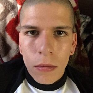 Tôi bị sụp mí hay sụp lông mày?