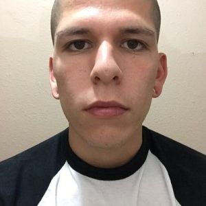 Tôi bị sụp mí hay sụp lông mày?