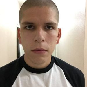 Tôi bị sụp mí hay sụp lông mày?