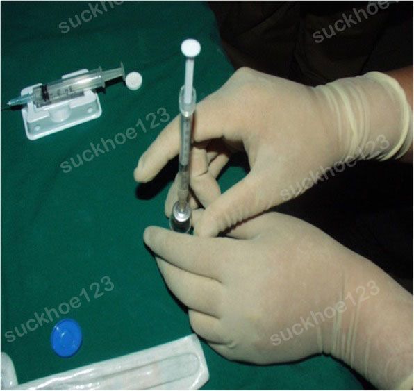 Hình 1 - Tiêm 2.5cc dung dịch nước muối vào lọ botulinum toxin