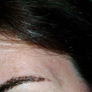 Điêu khắc chân mày có làm rụng chân mày vĩnh viễn không?