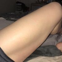 Đùi bị phồng lên sau căng da đùi có bình thường không?