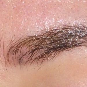 Vô tình làm bong vảy sau điêu khắc chân mày thì có sao không?