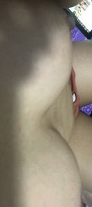 Ngực như vậy khi nằm có bình thường không ạ?