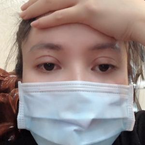 Mí vẫn còn rất to sau 1 tháng cắt mí