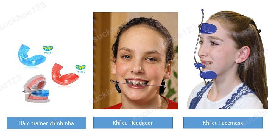 Một số khí cụ chỉnh nha