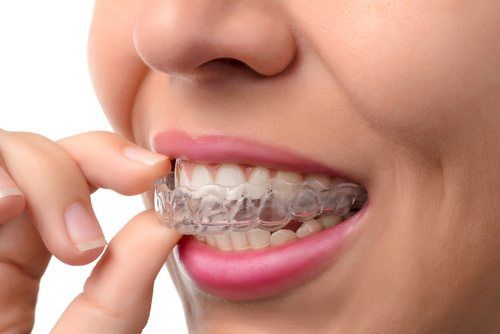 hàm duy trì tháo lắp1
