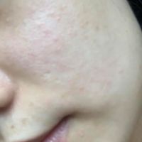 Nên ngưng hết các sản phẩm skincare không?