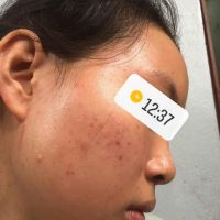 Xin lời khuyên về cách chăm sóc cho da nhạy cảm, hỗn hợp thiên dầu? Xin lời khuyên về cách chăm sóc cho da nhạy cảm, hỗn hợp thiên dầu?