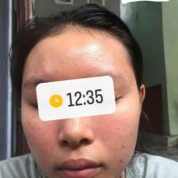 Xin lời khuyên về cách chăm sóc cho da nhạy cảm, hỗn hợp thiên dầu? Xin lời khuyên về cách chăm sóc cho da nhạy cảm, hỗn hợp thiên dầu?