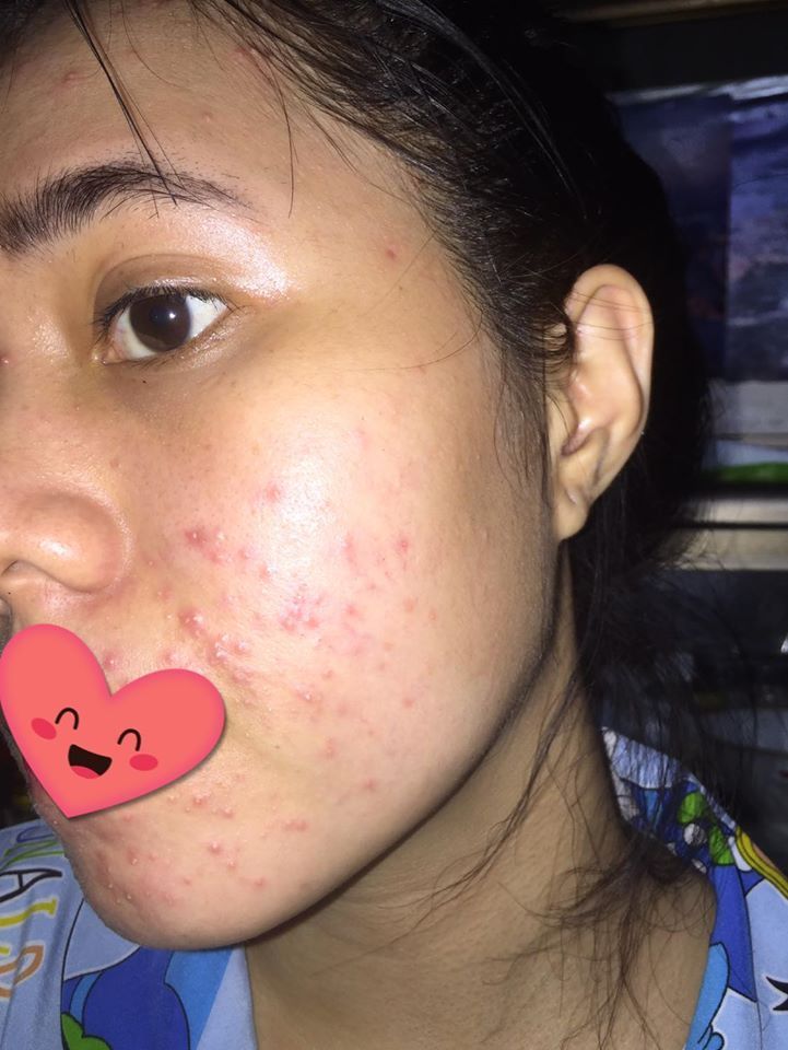 Bài học để đời!