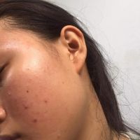 Xin lời khuyên về cách chăm sóc cho da nhạy cảm, hỗn hợp thiên dầu? Xin lời khuyên về cách chăm sóc cho da nhạy cảm, hỗn hợp thiên dầu?