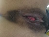 Âm vật như này liệu có bình thường không ạ?