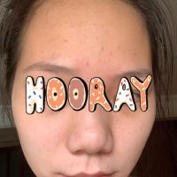 Nên ngưng hết các sản phẩm skincare không?