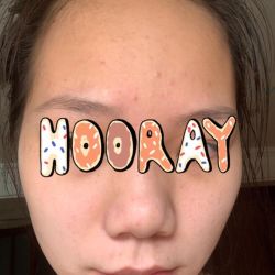 Nên ngưng hết các sản phẩm skincare không?