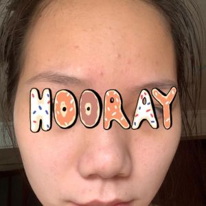 Nên ngưng hết các sản phẩm skincare không?