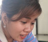 Làm gì để hết sẹo lõm ở mũi và 2 bên má?