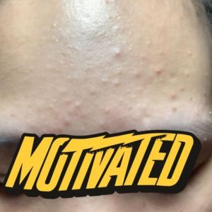 Nên ngưng hết các sản phẩm skincare không?