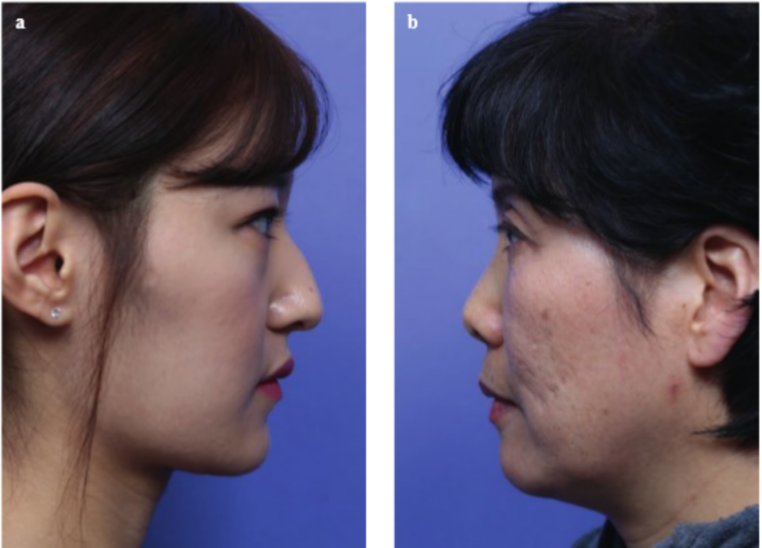 đánh giá đầu mũi 2