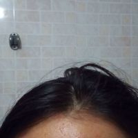 Chu trình skincare cho da mặt mụn ẩn, mụn viêm, mụn do nội tiết? Chu trình skincare cho da mặt mụn ẩn, mụn viêm, mụn do nội tiết?