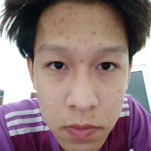 Tìm sản phẩm trị mụn nhanh